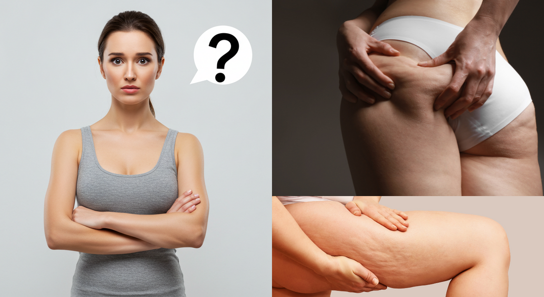 Como Reduzir Celulites de Forma Rápida e 100% Natural